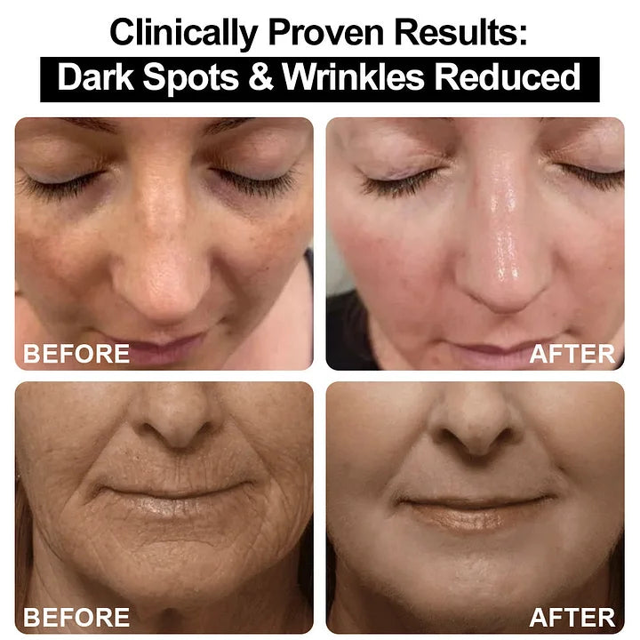 Creme Firmador Anti Flacidez e Envelhecimento