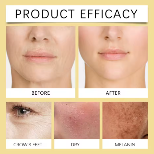 Biancat™ Creme Lifting de Veneno de Abelha