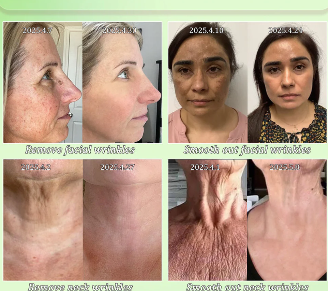 Creme Firmador Jorondy®