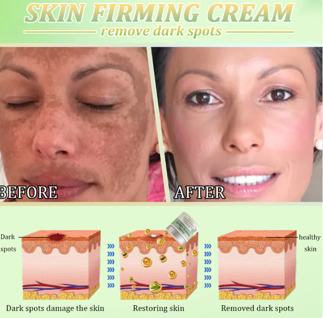 Creme Firmador Jorondy®