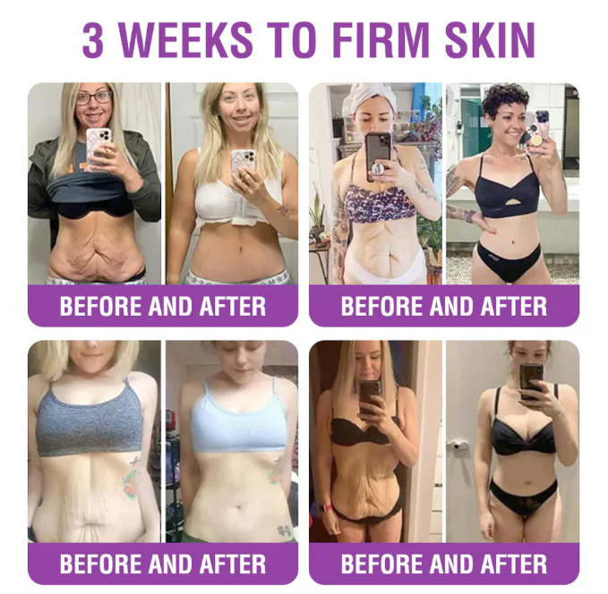 Creme Restaurador de Pele Furzero® Bakuchiol