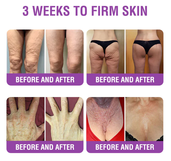 Creme Restaurador de Pele Furzero® Bakuchiol