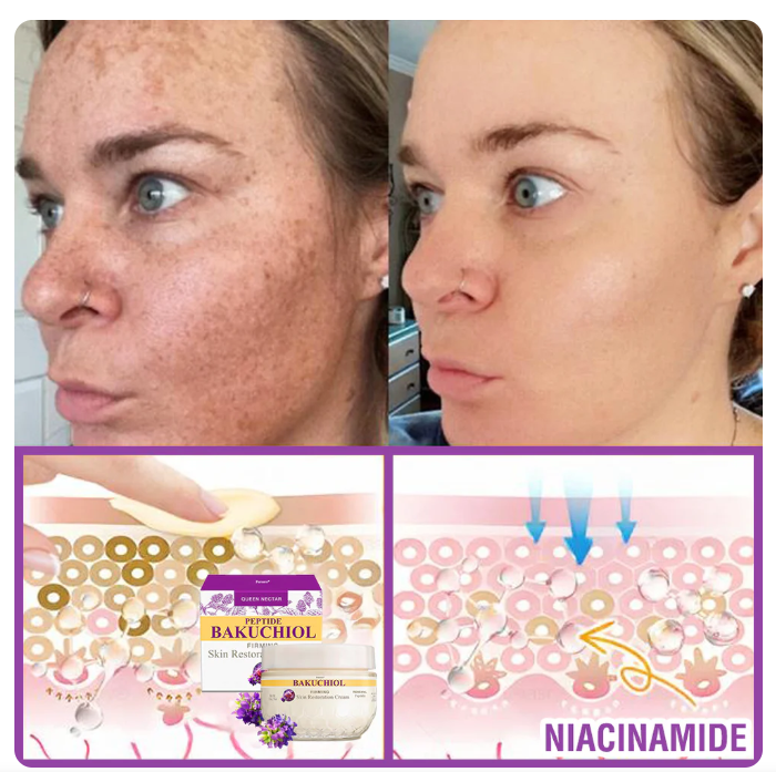 Creme Restaurador de Pele Furzero® Bakuchiol