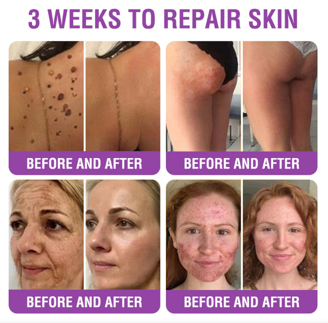 Creme Restaurador de Pele Furzero® Bakuchiol