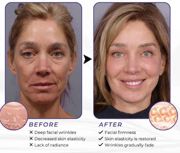 Creme Firmador de Pele Avançado ElastaPro Emu Oil