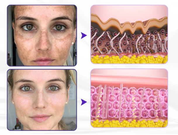 Creme Firmador de Pele Avançado ElastaPro Emu Oil