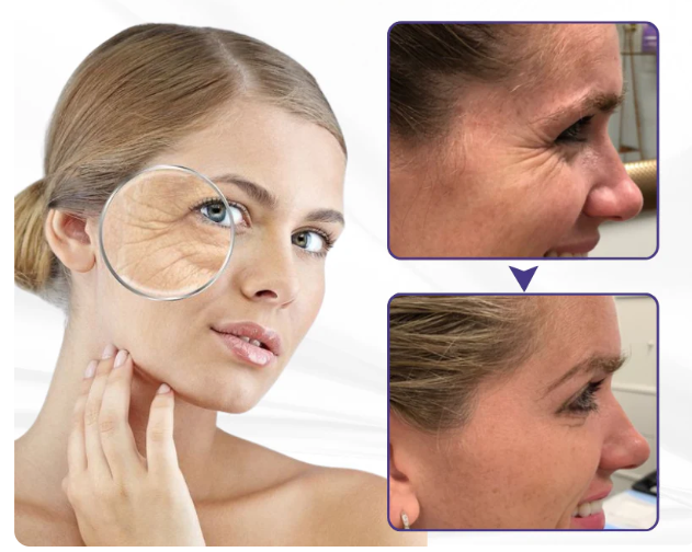 Creme Firmador de Pele Avançado ElastaPro Emu Oil