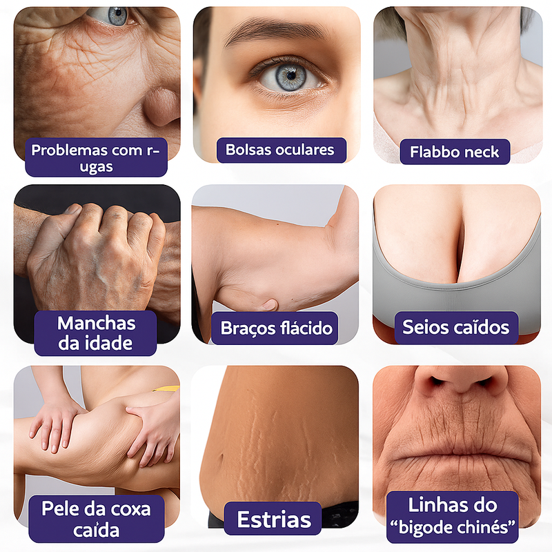 Creme Firmador de Pele Avançado ElastaPro Emu Oil
