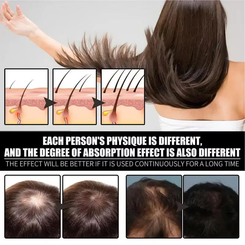 Cápsulas avançadas de crescimento capilar