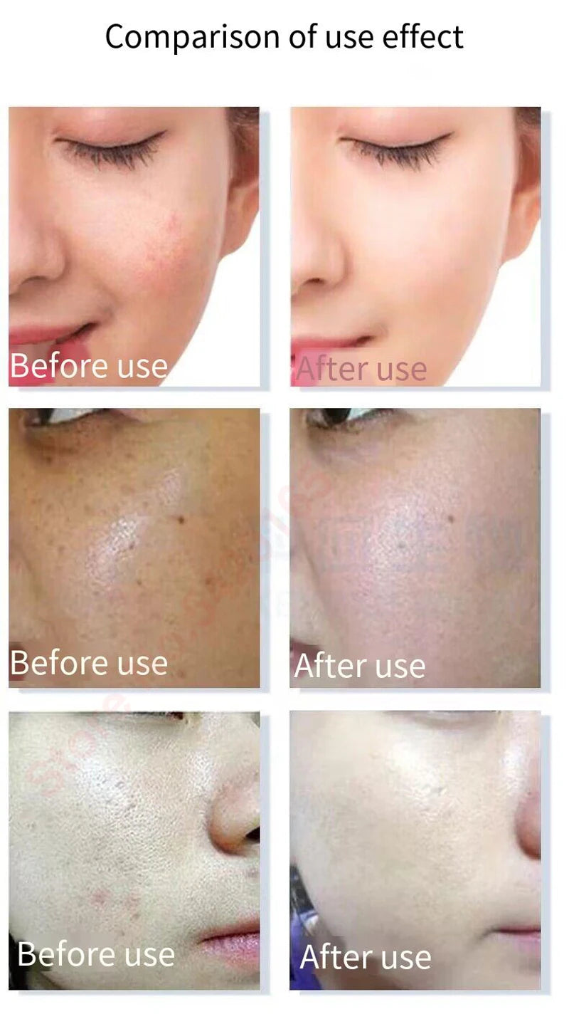 Sistema de Colágeno Nano-Seda Liofilizado Antirrugas