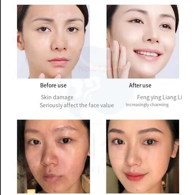 Sistema de Colágeno Nano-Seda Liofilizado Antirrugas