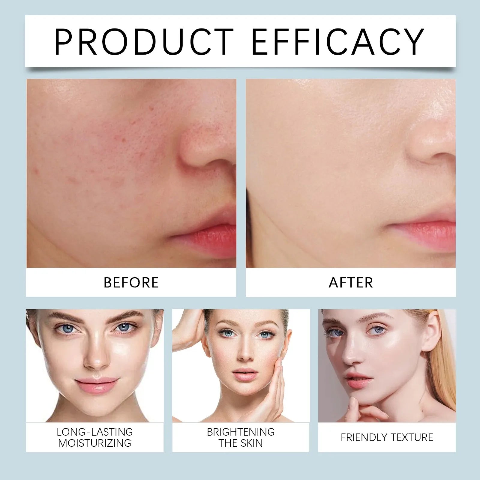 Creme antirrugas Dobshow® Botox 50g!