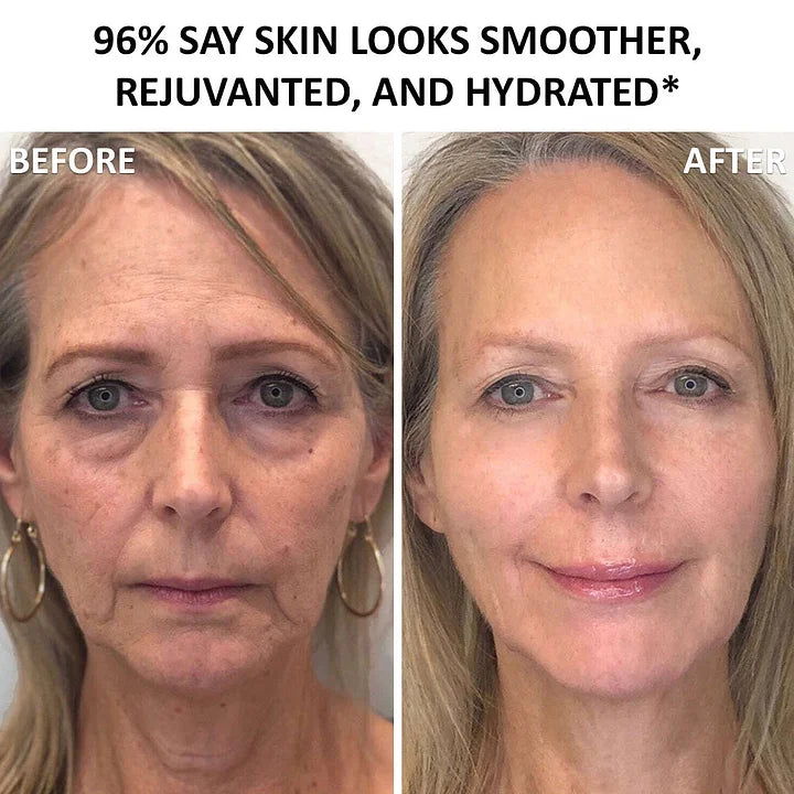 Creme Firmador Anti Flacidez e Envelhecimento