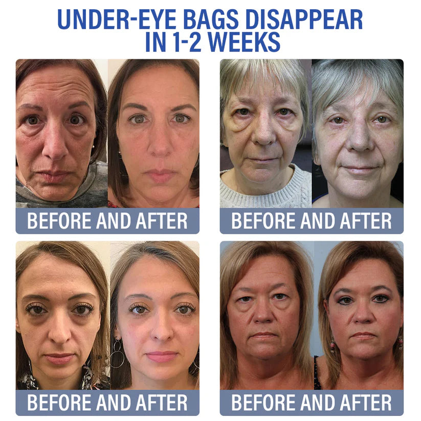 Creme para os olhos, linhas finas, rugas, olheiras, manchas escuras e antienvelhecimento diário