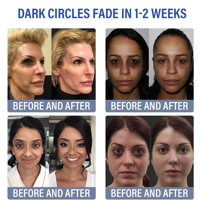 Creme para os olhos, linhas finas, rugas, olheiras, manchas escuras e antienvelhecimento diário